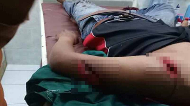 Tiga Pemuda Lubukpauh Dibacok