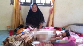 Kasihan... Kanker Riyanti Makin Parah, Pemerintah Tak Serius Membantu