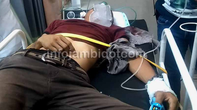 Penjambret Kritis Diamuk Massa