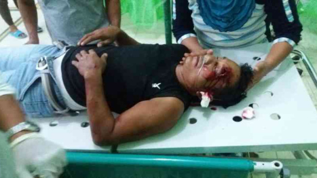 Kecelakaan Sepeda Motor, Dua Korban Kritis