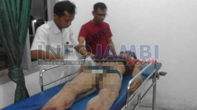 Diteriaki Maling, Zainal Tewas Dikeroyok