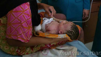 Heboh Bayi Penderita Kelainan Kulit Ditolak Rumah Sakit