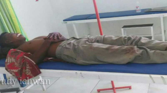 Dua Warga Suku Anak Dalam Babak Belur Dikeroyok