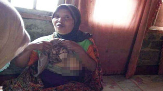 Nenek Sani Derita Kanker Payudara Memprihatinkan