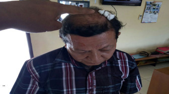 Tak Terima Ditegur, Preman Pasar Gebuk Warga