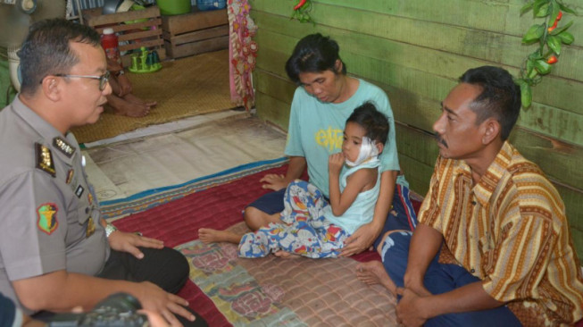 Anak Penderita Tumor, Mendapat Kunjungan Kepala Rumkit Bhayangkara