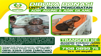 Adik Agung Korban Terbakar, Membutuhkan Uluran Tangan untuk Biaya Operasi