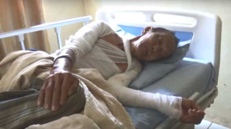 Korban Kebakaran Pangkal Duri Berangsur Sembuh
