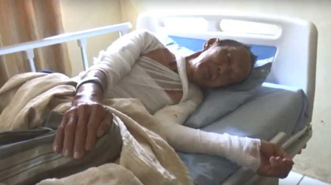 Korban Kebakaran Pangkal Duri Berangsur Sembuh