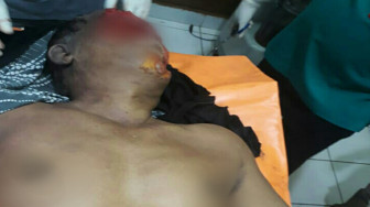 Jamaludin Meninggal, Diduga Akibat Cakaran Binatang Buas