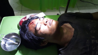 Dipukul Security PT KDA, Warga SAD Dilarikan ke RSUD