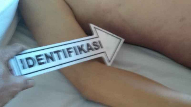 Ini Dugaan Sementara Penyebab Kematian Tamu Hotel Abadi Suite