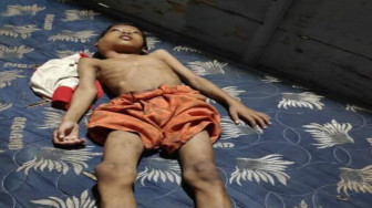 Bocah Penderita Tumor Ganas Butuh Uluran Tangan Dermawan