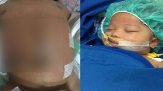 Perjalanan Panjang Menyelamatkan Caesa, Bayi Asal Sungaipenuh Penderita Sirosis Hati