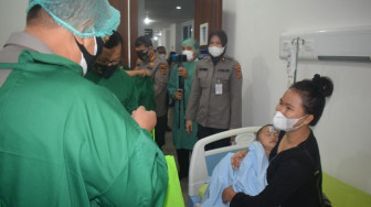 Polda Jambi Gelar Operasi Bibir Sumbing Gratis Selama Dua Hari