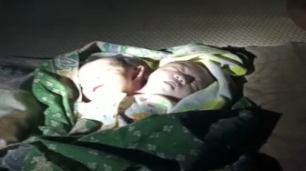 Bayi Terlahir Satu Tubuh, Dua Kepala