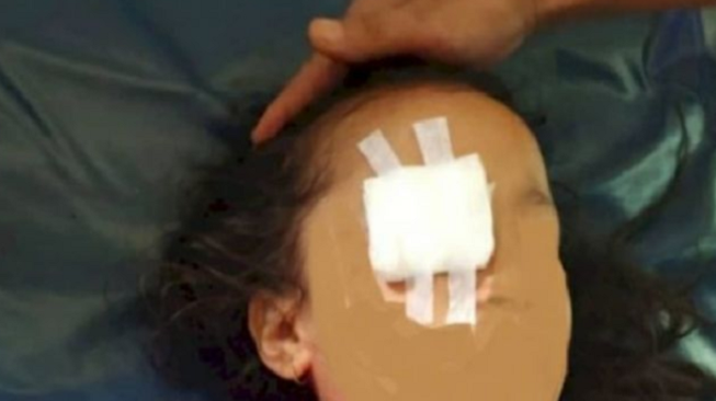 Sudah Gila, Orang Tua Congkel Mata Anak Demi Pesugihan