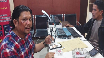 Polisi Minta Pelaku Penghajar Ketua SMSI Serahkan Diri