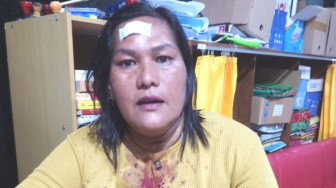 Dipukul Mantan Suami, Wanita di Merangin Babak-Belur