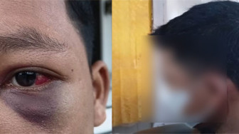 Santri Diduga Dianiaya Guru, Sempat Pingsan dan Mata Bengkak